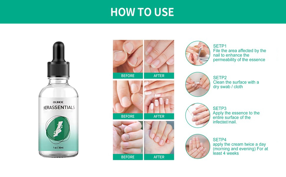 Kerassentials